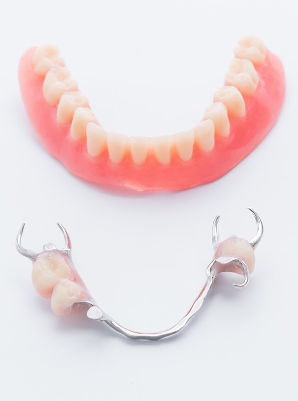 denture repairs kent